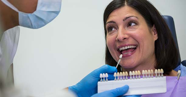 Veneers